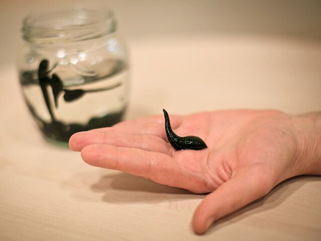 uporaba za zdravljenje artroze kolenskega sklepa